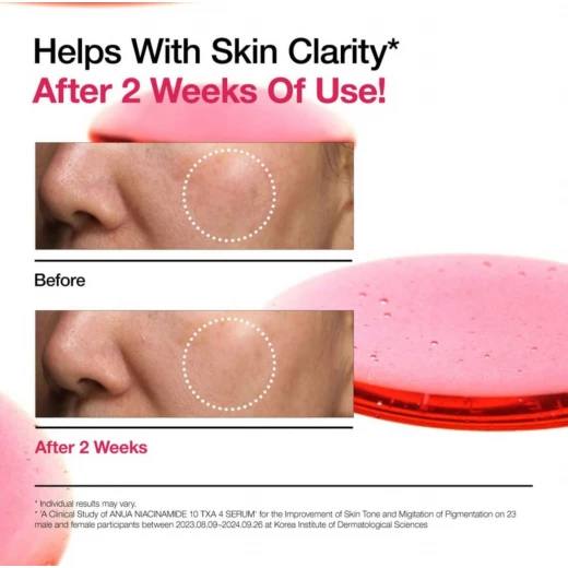 سيروم ANUA Niacinamide 10 + TXA 4 – للبشرة الزجاجية والإشراقة الطبيعية
