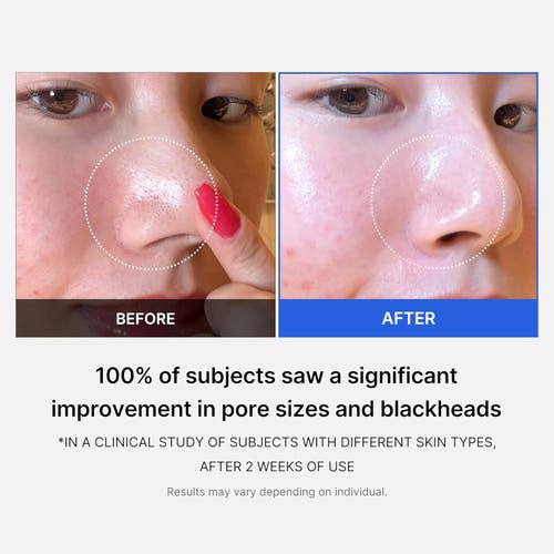 وسادات Zero Pore Pads 2.0 – تونر مقشر مزدوج الملمس للعناية بالبشرة