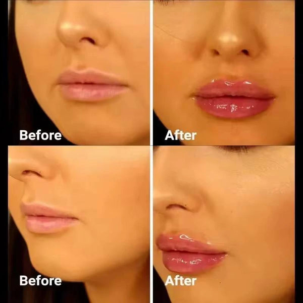 _ احصلي على شفاه منفوخه وجذابة خلال 5 دقائق _بدون إبر 💋